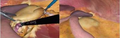 點(diǎn)擊瀏覽下一頁