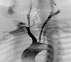 點擊瀏覽下一頁