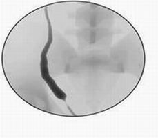點擊瀏覽下一頁