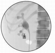 點擊瀏覽下一頁