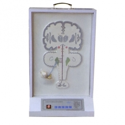 平衡覺(jué)傳導(dǎo)電動(dòng)模型