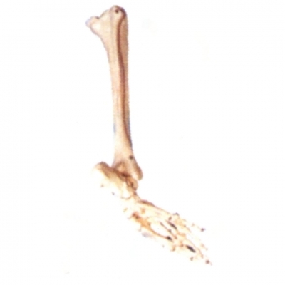 足骨、腓骨和脛骨模型