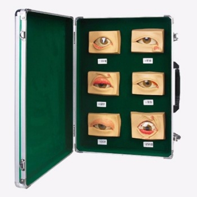 常見(jiàn)眼病模型