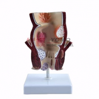 結(jié)腸演示模型